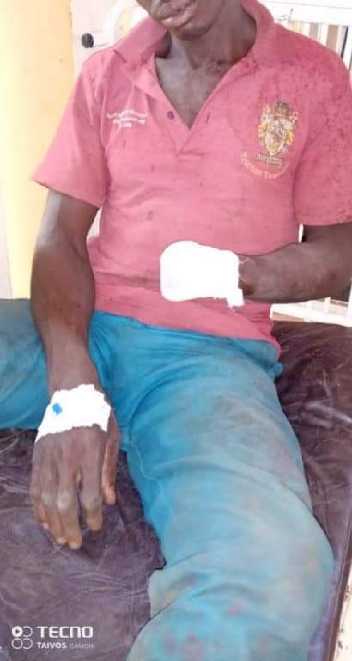 CONFLIT ENTRE AGRICULTEURS ET ELEVEURS A KALALE : Un bouvier ampute le poignet d&rsquo;un cultivateur