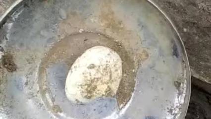 INSOLITE A NIKKI : Une femme accouche un objet à l&rsquo;image d&rsquo;un caillou