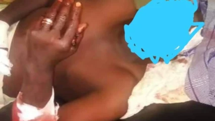 BENIN/COMMUNALE 2020 :  Un candidat charcuté à Matéri