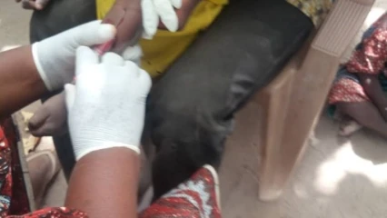 TCHAOUROU/DES CAS DE VIRUS DE VARICELE ET DE ROUGEOLE : Plusieurs enfants contaminés