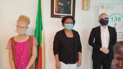 JOURNEE MONDIALE DE SENSIBILISATION A L’ALBINISME : La ministre Tognifodé réitère sa solidarité aux personnes atteintes d’albinisme