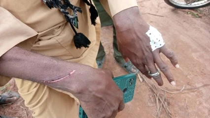 Nouvelle attaque à domicile à Sinendé: un éleveur et son épouse pris pour cible par des Iani