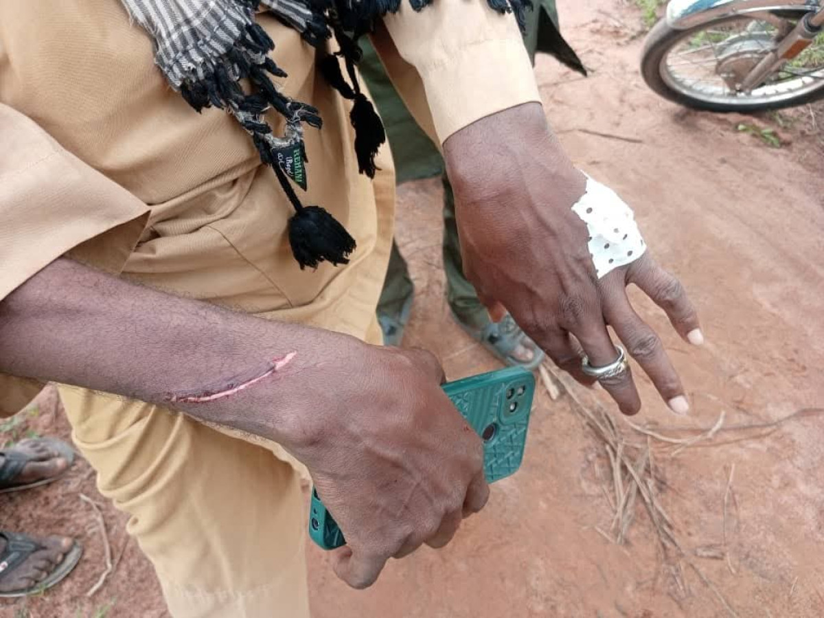 Nouvelle attaque à domicile à Sinendé: un éleveur et son épouse pris pour cible par des Iani