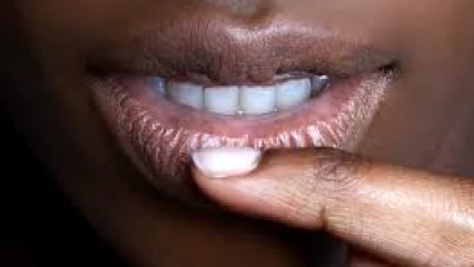 HUILES A LEVRES : De la beauté à l&rsquo;intoxication