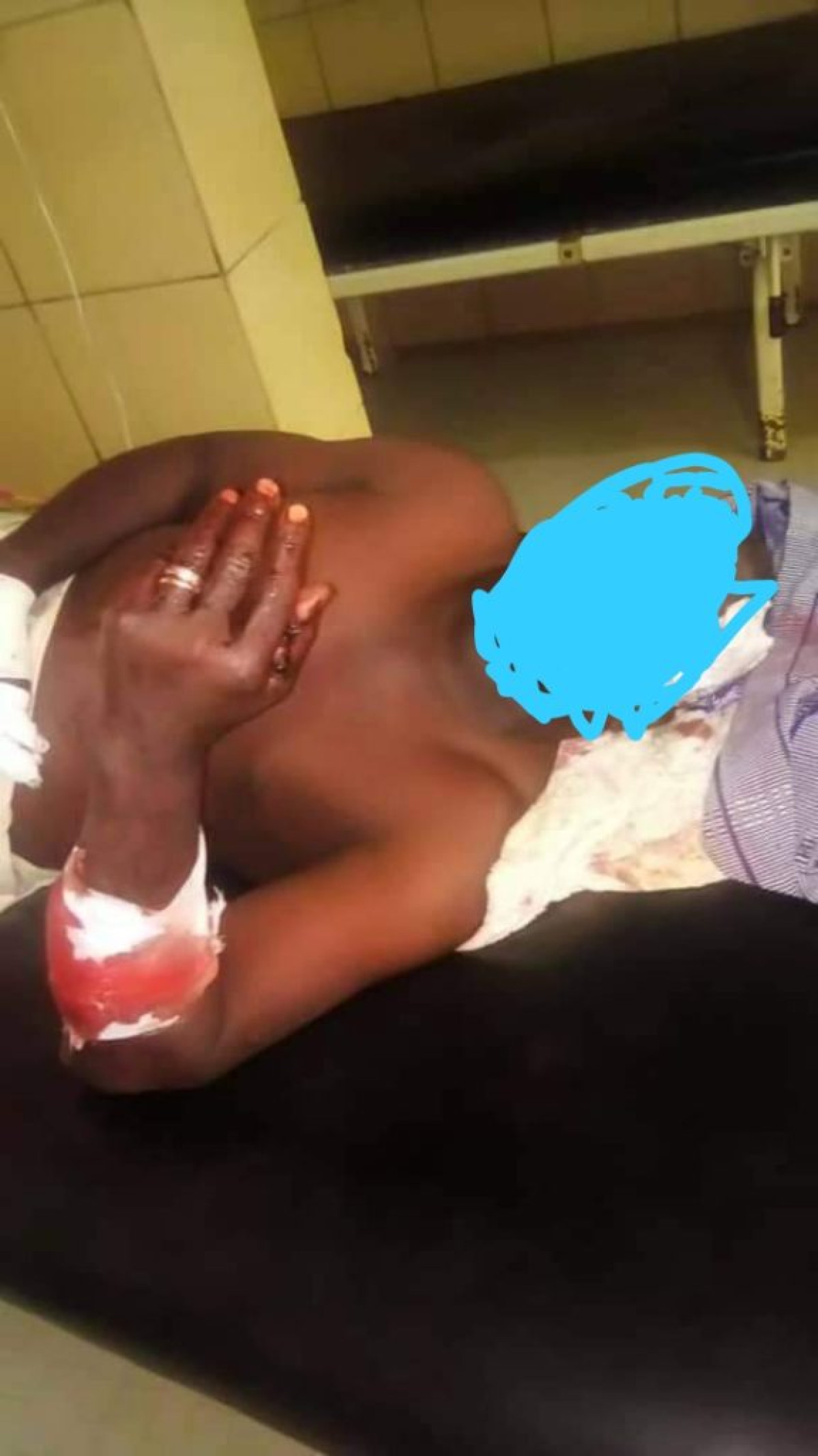 BENIN/COMMUNALE 2020 :  Un candidat charcuté à Matéri