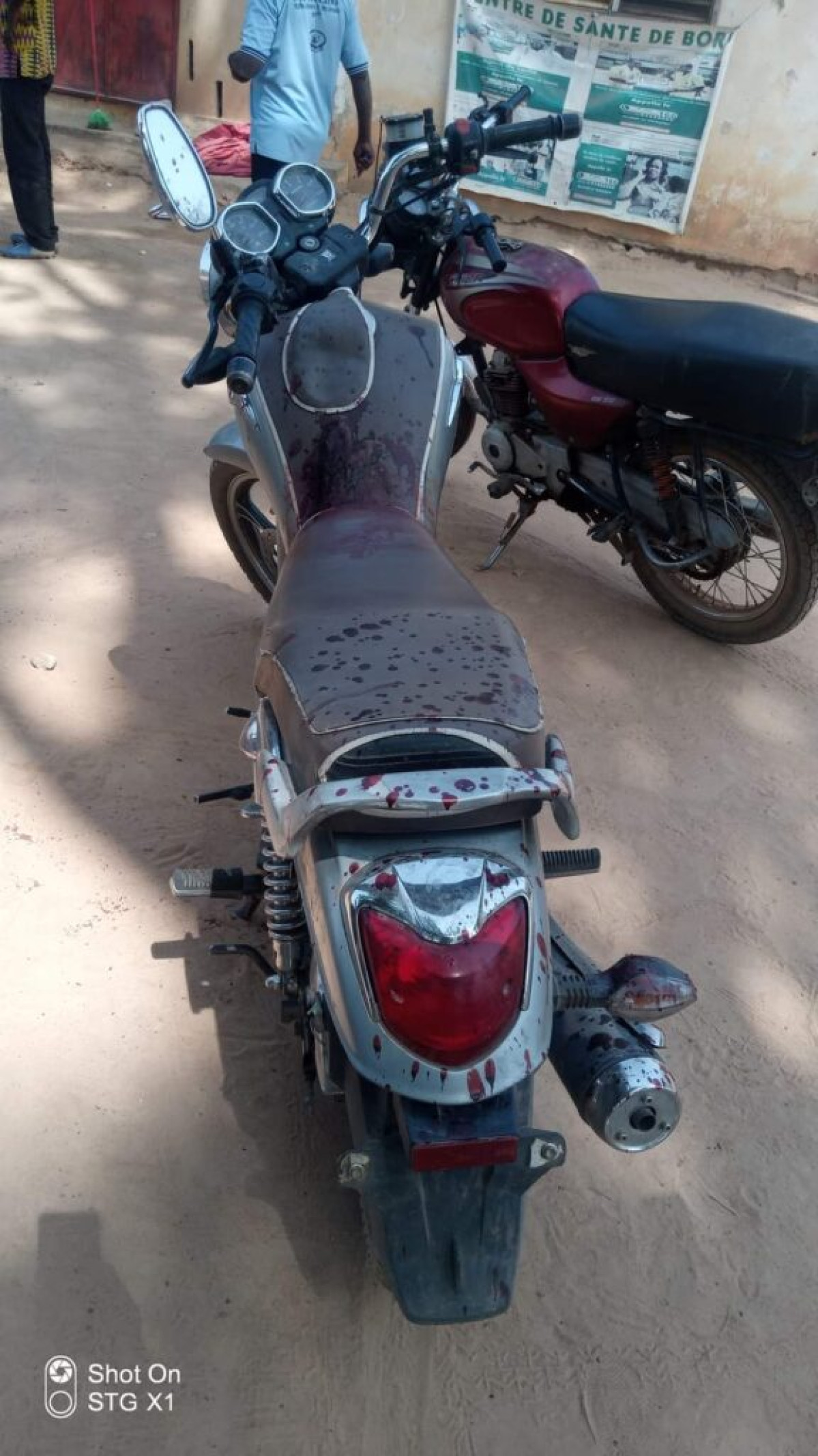 N’DALI : Un éleveur assène des coups de machette à un agriculteur