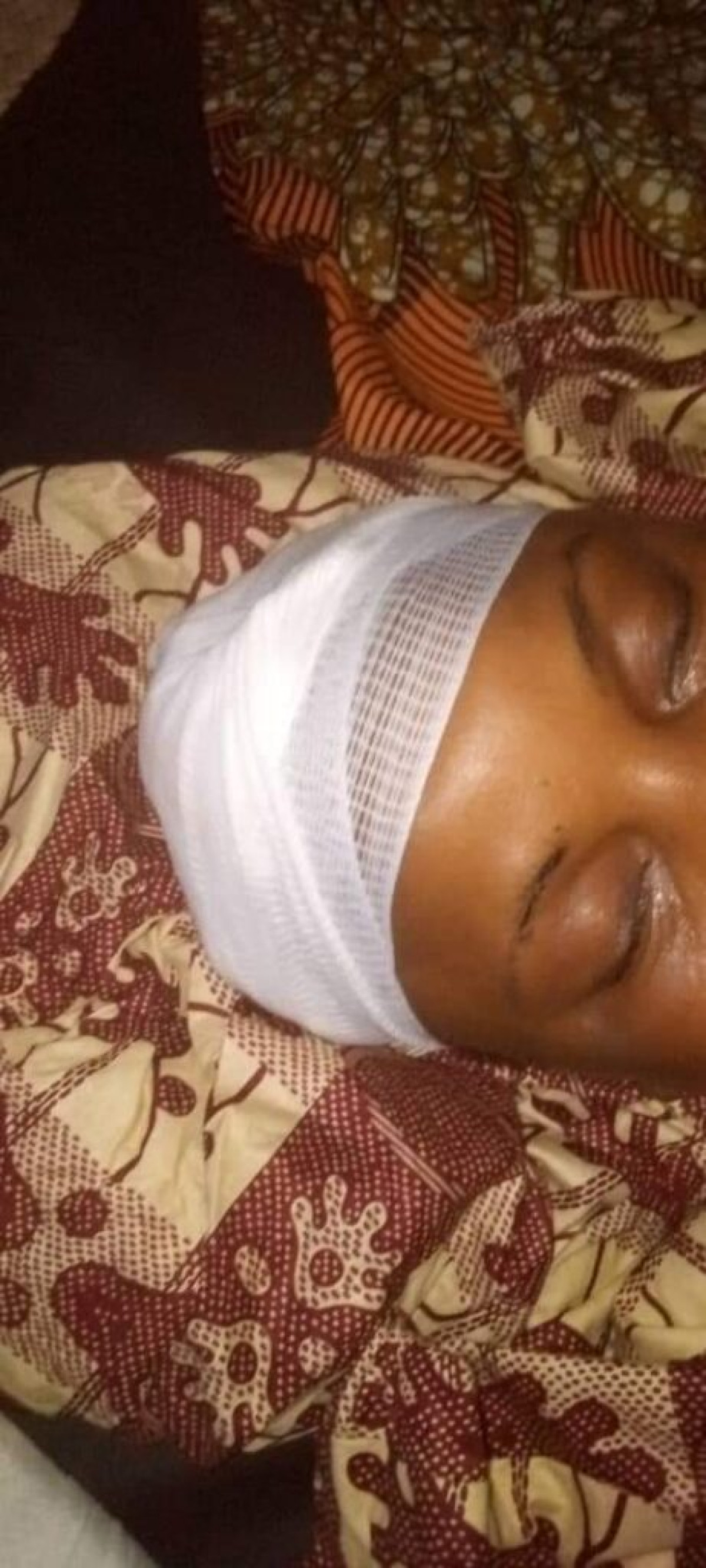 NIKKI/SOUPÇONNEE D&rsquo;INFIDELITE :  Une femme battue à sang par son mari
