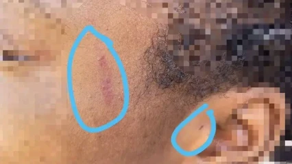 ABOMEY-CALAVI : Une étudiante victime d&rsquo;une agression sexuelle