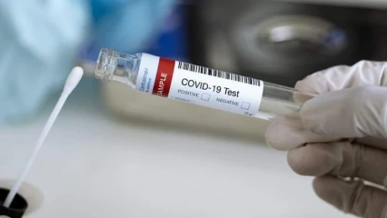 BENIN/COVID-19 : Le test Pcr désormais prescrit sur ordonnance médicale