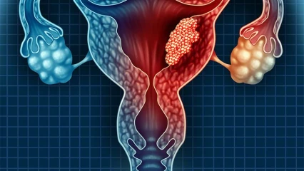 CANCER DU COL DE L&rsquo;UTÉRUS : Il faut vaincre la fatalité 
